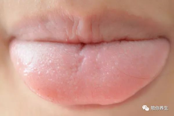 舌頭知百病 能預示癌症 教你從舌頭上看疾病信號 健康 第3張