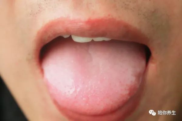 舌頭知百病 能預示癌症 教你從舌頭上看疾病信號 健康 第4張