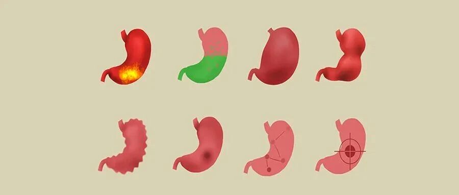 节假日期间饮食不规律，易加重胃病，3个护胃建议，让你过个健康年