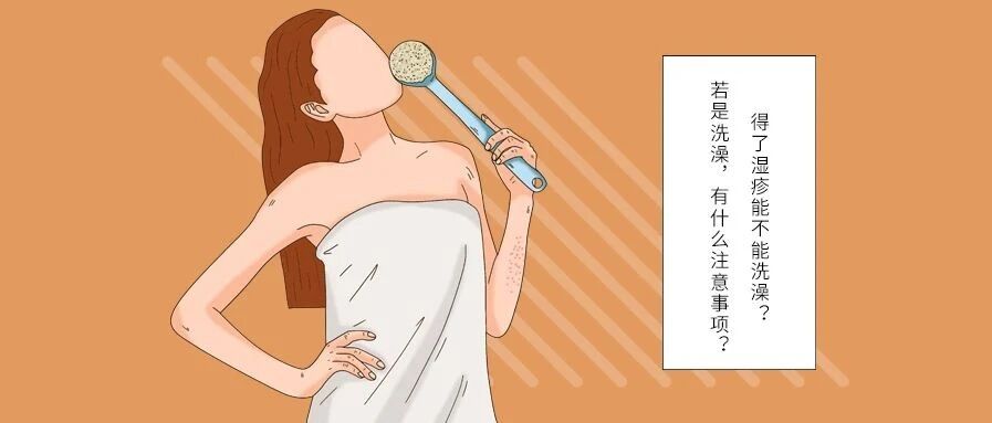 得了湿疹能不能洗澡？若是洗澡，有什么注意事项？