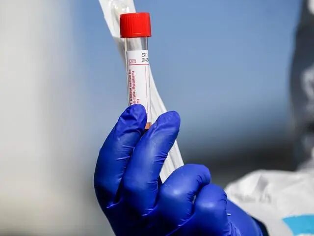 疫苗巨头商计划量产新冠疫苗：优先满足印度人，价格亲民（组图） - 3