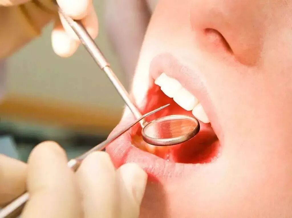 为什么牙医不用开口器为什么牙医不在微信（网上）看牙？_https://www.jmylbn.com_新闻资讯_第17张