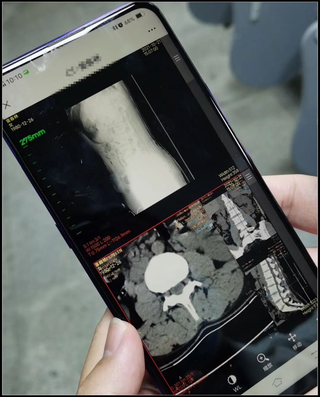 医学胶片怎么做医院【我为群众办实事】有了“云胶片”，看诊更方便！_https://www.jmylbn.com_新闻资讯_第6张