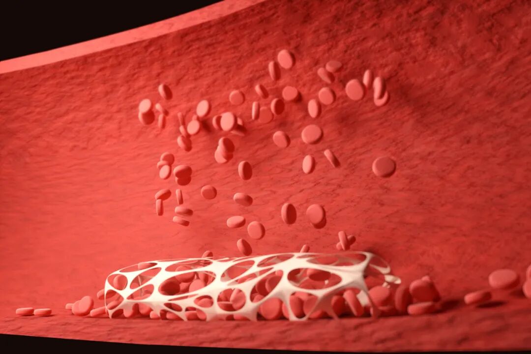 天基权治疗仪怎么样天基权科普 ｜ 5.18全国血管健康日 天基权半导体激光治疗仪为血管健康保驾护航_https://www.jmylbn.com_新闻资讯_第2张