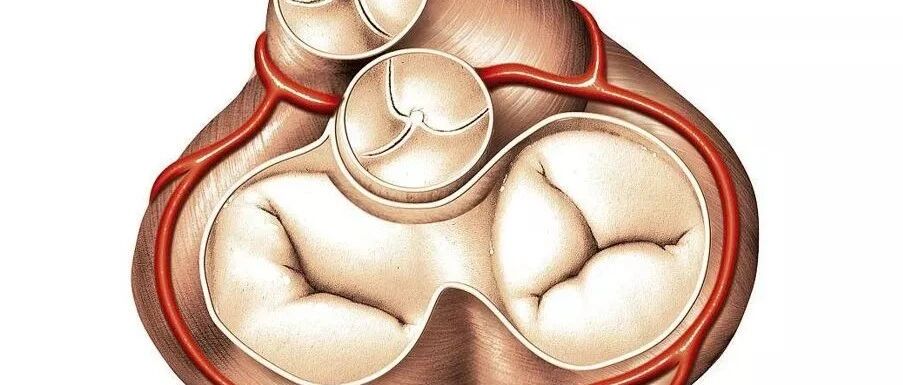 做超声发现“二尖瓣、三尖瓣少量反流”，是心脏病吗？