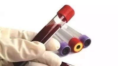 发现高血压，你还应该化验血和尿！