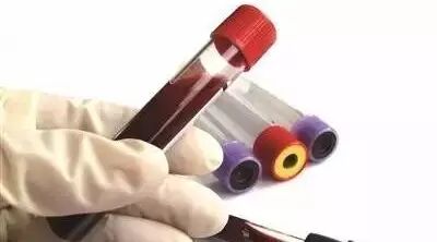 服用降脂药后多长时间需要验血复查？