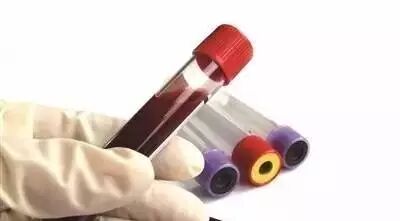 饮食很清淡，为什么甘油三酯也会增高？