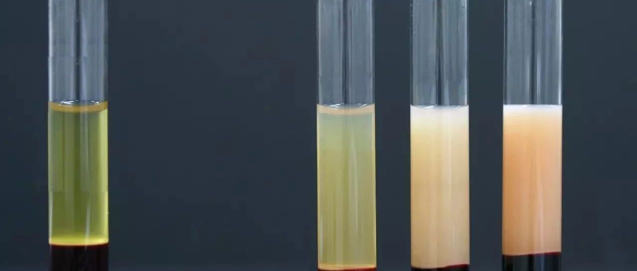 甘油三酯为啥会增高？应该如何处理？