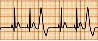 一图说清！各类心血管疾病