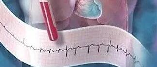 心跳快是心脏病吗？需要治疗吗？