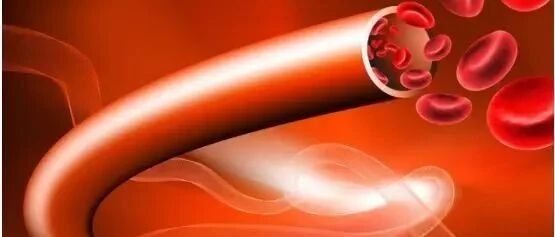 岁数不大为啥出现了颈动脉斑块？