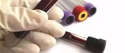 血脂超过多少就算是高脂血症？