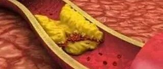 每天能吃几个鸡蛋？