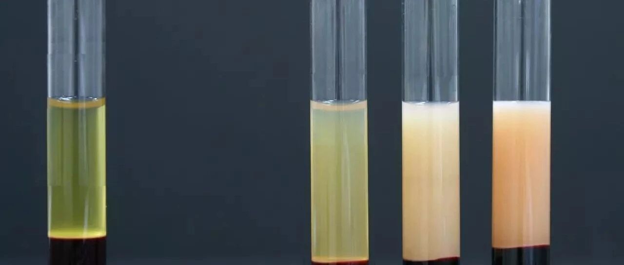 【写给心内科医生】降胆固醇治疗，你必须掌握的知识点