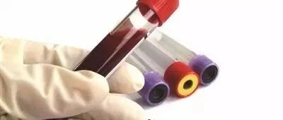 天天素食为啥也会发生甘油三酯增高？