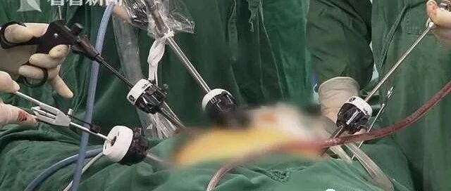 就因一颗枣！69岁男子被送上手术台，但这个错误很多人在犯！