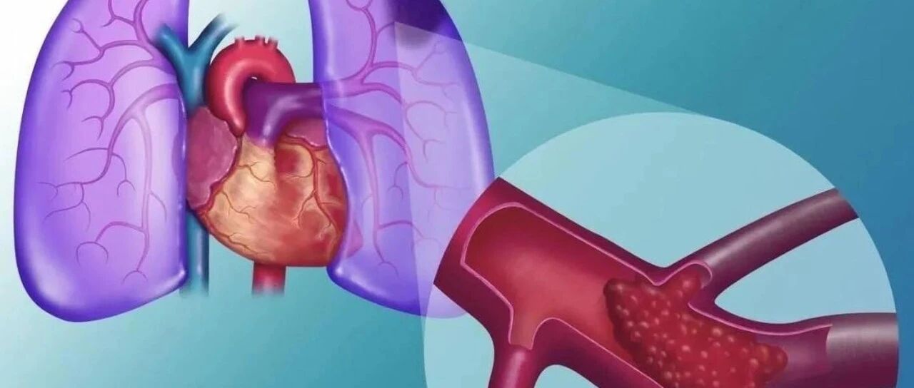 武汉74岁老人意外捡回一命！这种病太狡猾，还以为是戴口罩憋的……