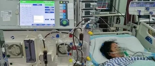 4颗止痛药下肚，浙江一53岁女子全身出血不止多器官衰竭，急送ICU！最终……