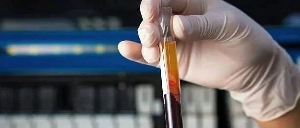 国人高胆固醇血症10年增3倍！这4个原因值得深思！