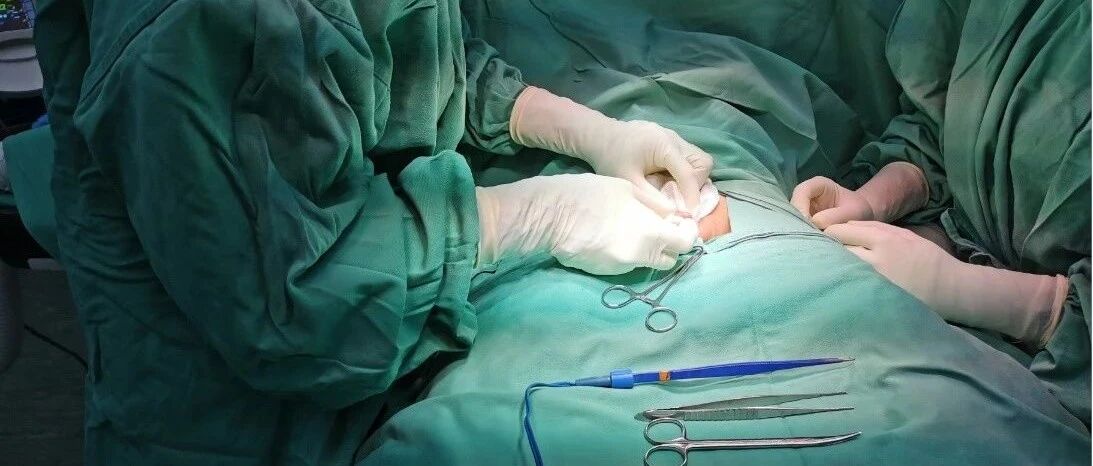 5岁男孩1年反复出现咽痛夜间打鼾！从气管内竟取出一只...