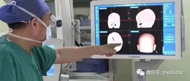 揪心！水果刀紧贴眼球扎入，1岁女婴颅内留下4厘米断刃......