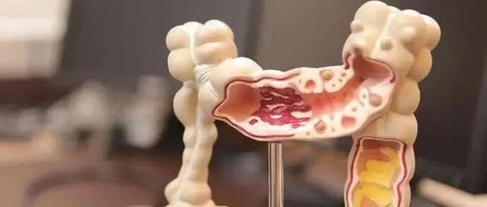 欣喜若狂暴瘦近20斤！以为减肥成功，没想到患上这2种癌！