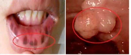 只因医生多看了一眼，救了病人一命！若不是发文曝光，你永远无法看到这一幕！