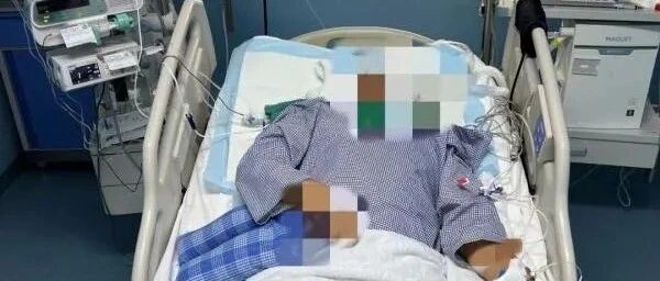 一男子被生锈铁钉扎伤脚，ICU里住了近2个月！