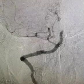 做个“马杀鸡”，陕西男子差点偏瘫！这个地方很脆弱别随便按