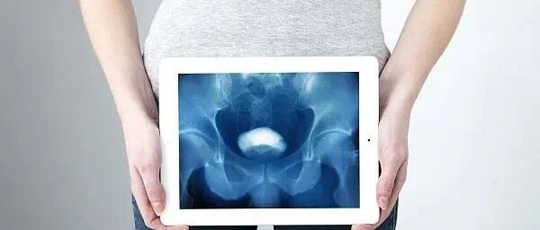 “笑尿了”是病，得治！60岁老妇尿失禁多年，直到子宫掉了出来……