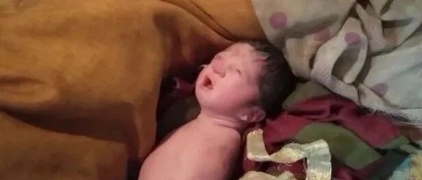 真可怜！这个女婴出生时没手没脚…医生说是他职业生涯中的首例…