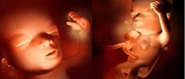 怀孕3周居然2次怀孕！肚中莫名多出个胎儿...最后生出“双胞胎”！