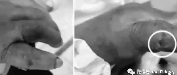 手指被螃蟹夹伤！肿大3倍被吓坏：开始腐烂了...