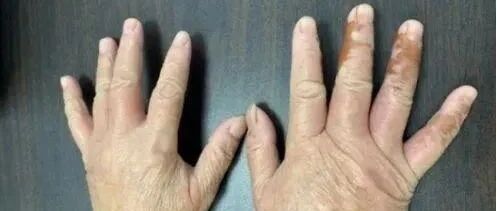 紧急提醒！这东西街头、公园正大量出现！你千万别随意“碰”……