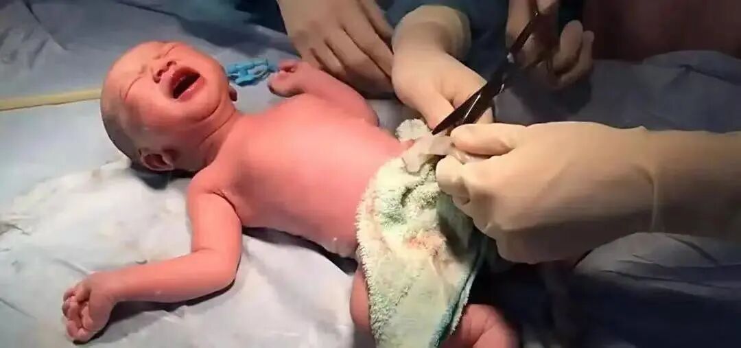 为什么剪脐带要先夹住剪脐带的时候到底是宝宝疼，还是妈妈疼？_https://www.jmylbn.com_新闻资讯_第4张
