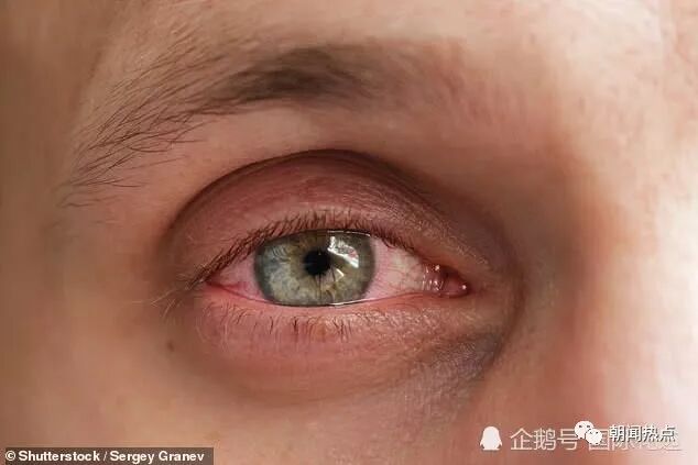 一次吃十倍剂量伟哥美国一男子差点瞎了