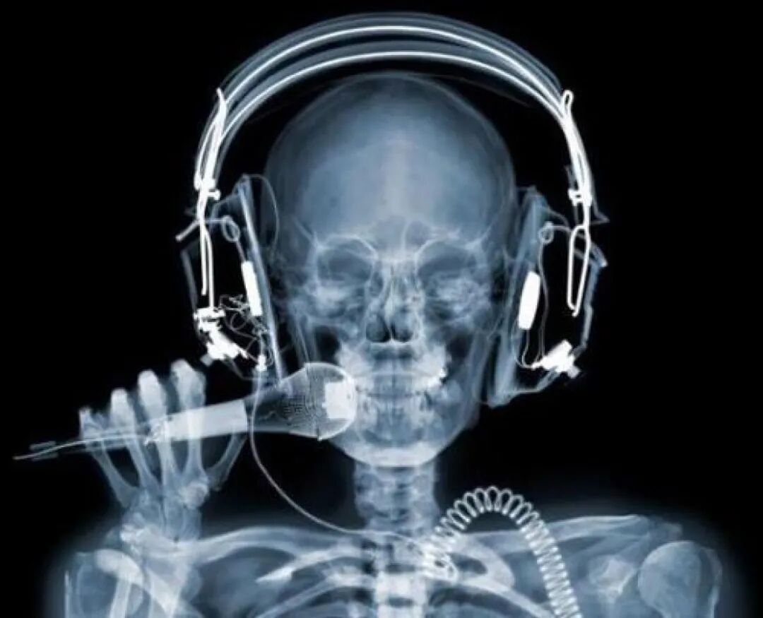 c射线是什么什么是X射线，它是如何被发现的，对人类有多大影响？_https://www.jmylbn.com_新闻资讯_第2张