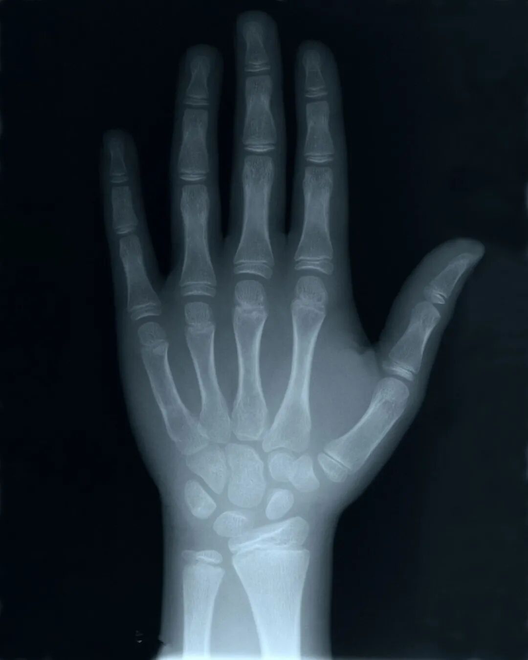 c射线是什么什么是X射线，它是如何被发现的，对人类有多大影响？_https://www.jmylbn.com_新闻资讯_第11张