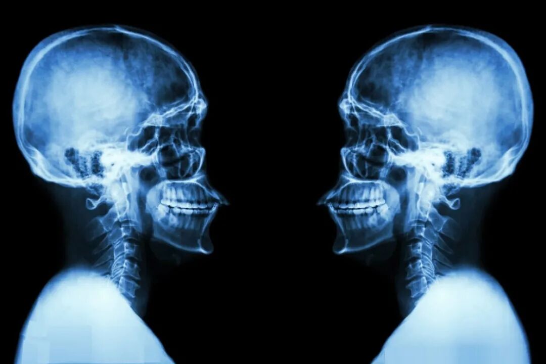 c射线是什么什么是X射线，它是如何被发现的，对人类有多大影响？_https://www.jmylbn.com_新闻资讯_第17张