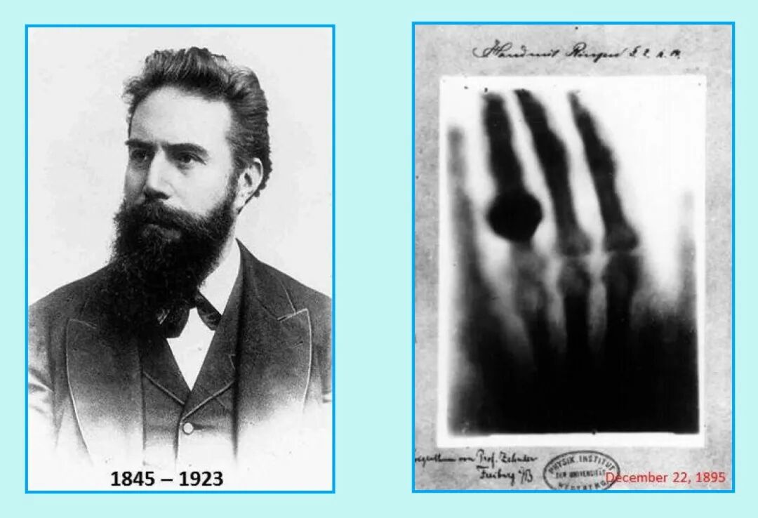 c射线是什么什么是X射线，它是如何被发现的，对人类有多大影响？_https://www.jmylbn.com_新闻资讯_第8张