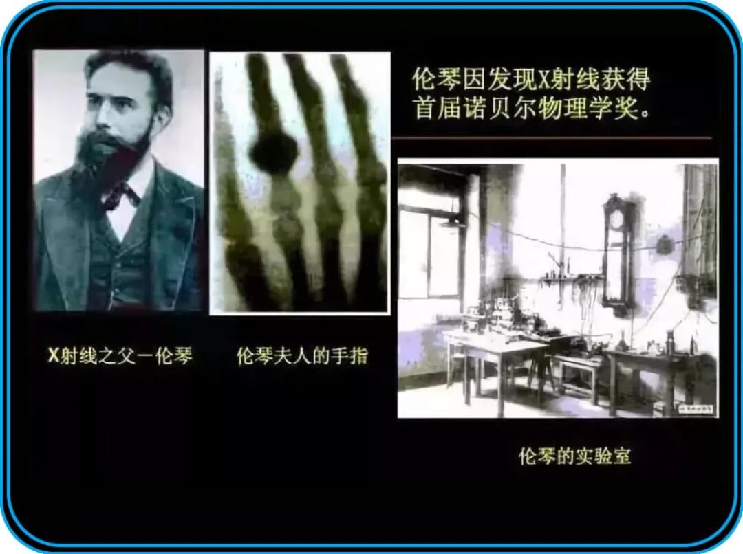 c射线是什么什么是X射线，它是如何被发现的，对人类有多大影响？_https://www.jmylbn.com_新闻资讯_第15张
