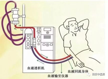 血滤机什么品牌好【健康科普】ICU的救命利器——床旁血滤机_https://www.jmylbn.com_新闻资讯_第5张