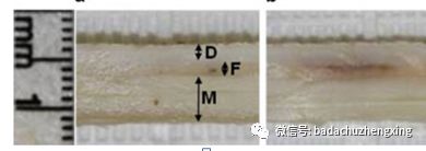 微波治疗机怎么使用天气热了，尴尬的腋臭多汗症_https://www.jmylbn.com_新闻资讯_第14张
