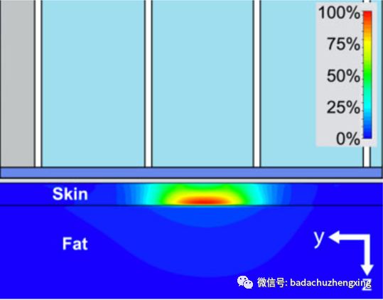 微波治疗机怎么使用天气热了，尴尬的腋臭多汗症_https://www.jmylbn.com_新闻资讯_第12张