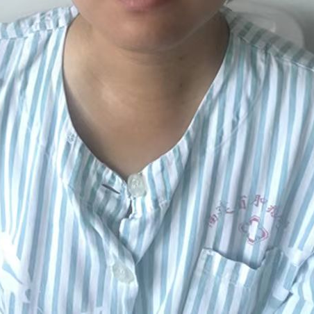 外科拉勾怎么拉突破！我院头颈外科经锁骨下入路腔镜甲状腺手术成熟，自主设计拉钩获国家级实用新型专利！_https://www.jmylbn.com_新闻资讯_第4张