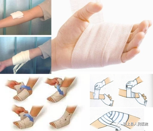 动脉什么压迫止血【科普】外伤后出血不要着急，教你几招快速止血_https://www.jmylbn.com_新闻资讯_第7张