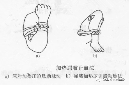 动脉什么压迫止血【科普】外伤后出血不要着急，教你几招快速止血_https://www.jmylbn.com_新闻资讯_第8张