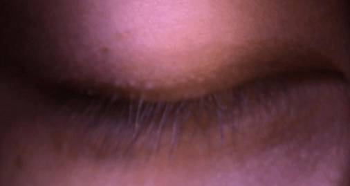 什么是裂隙灯【科普】裂隙灯下的眼睛是什么样的？_https://www.jmylbn.com_新闻资讯_第6张