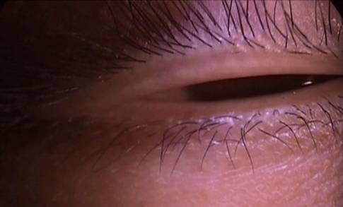 什么是裂隙灯【科普】裂隙灯下的眼睛是什么样的？_https://www.jmylbn.com_新闻资讯_第7张